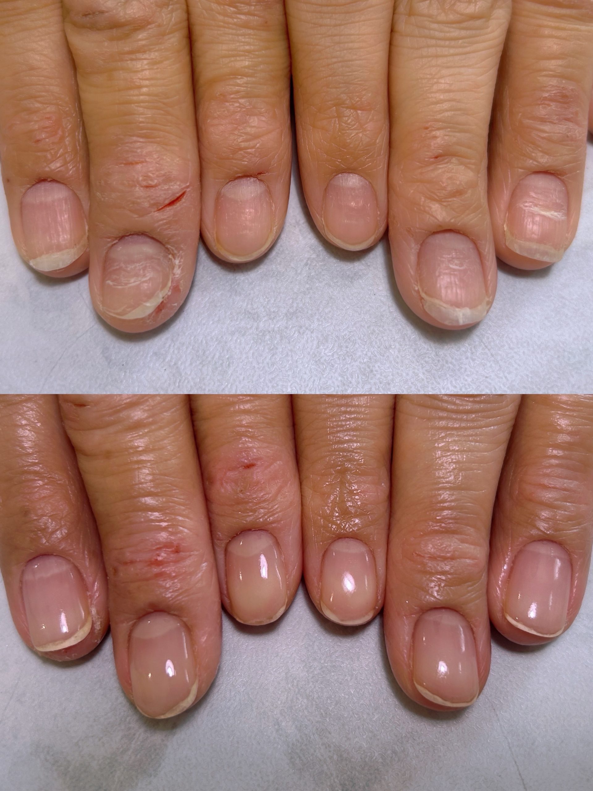 ビフォーアフター